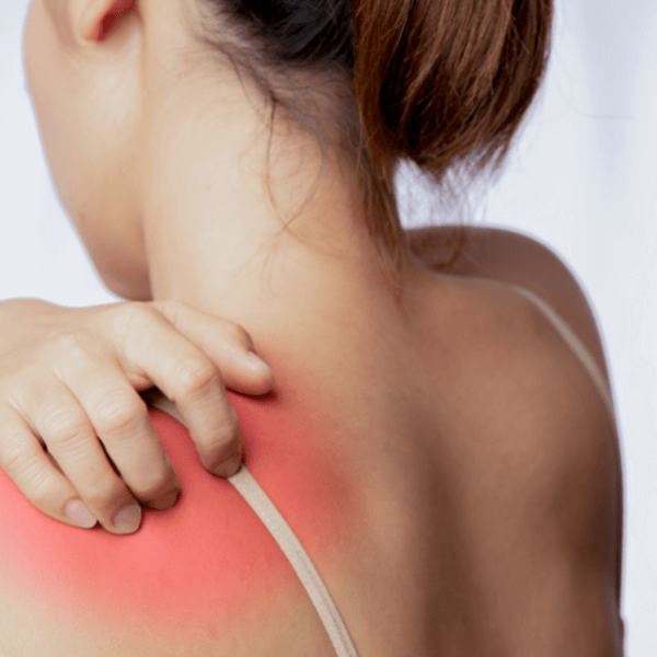 pest control statistics - Ticks and Tick-Bite Prevention Tips - a red radiating rash on woman's left shoulder