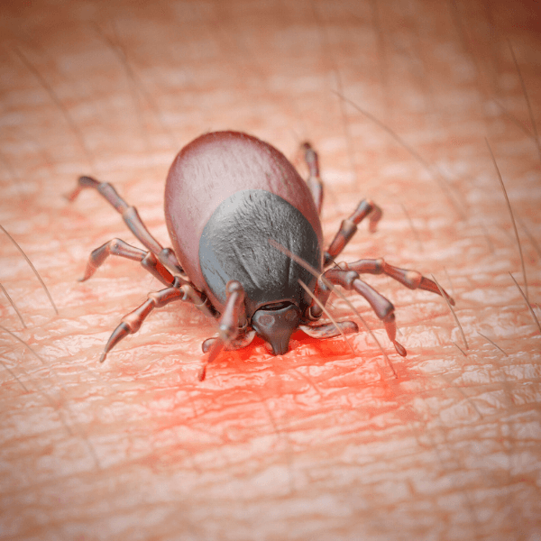 pest control statistics - Ticks and Tick-Bite Prevention Tips - tick sucking blood through the skin